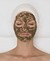 BioPeelingTreatmentKlein